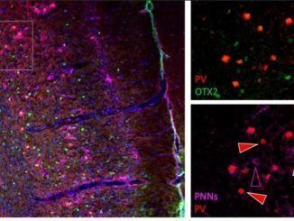 En la imagen, la proteína "OTX2" en verde internalizándose en las neuronas (rojo) de la corteza prefrontal que están rodeadas de redes perineuronales (rosa).