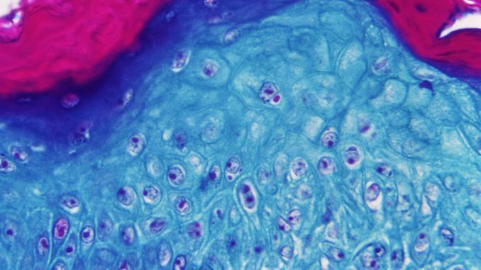 Imagen ampliada con un microscopio de una muestra de piel de un mono infectado con el virus de la viruela del mono cedida por el Center for Disease Control and Prevention. EFE
