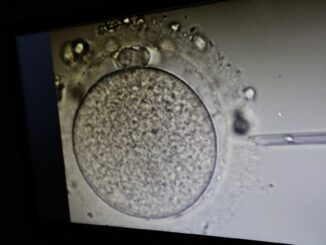 Vista de un análisis de óvulos en un microscopio, en una fotografía de archivo. EFE/Bienvenido Velasco