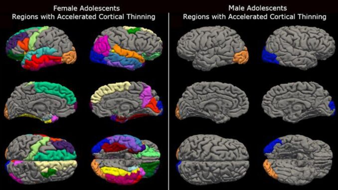 Una nueva investigación del Institute for Learning & Brain Sciences, o I-LABS, de la Universidad de Washington, descubrió que los confinamientos durante la pandemia de Covid-19 provocaron una maduración cerebral inusualmente acelerada en los adolescentes que fue más pronunciada en las mujeres, como se ve a la izquierda. Fotografía facilitada por I-LABS de la Universidad de Washington. EFE
