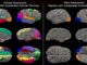 Una nueva investigación del Institute for Learning & Brain Sciences, o I-LABS, de la Universidad de Washington, descubrió que los confinamientos durante la pandemia de Covid-19 provocaron una maduración cerebral inusualmente acelerada en los adolescentes que fue más pronunciada en las mujeres, como se ve a la izquierda. Fotografía facilitada por I-LABS de la Universidad de Washington. EFE