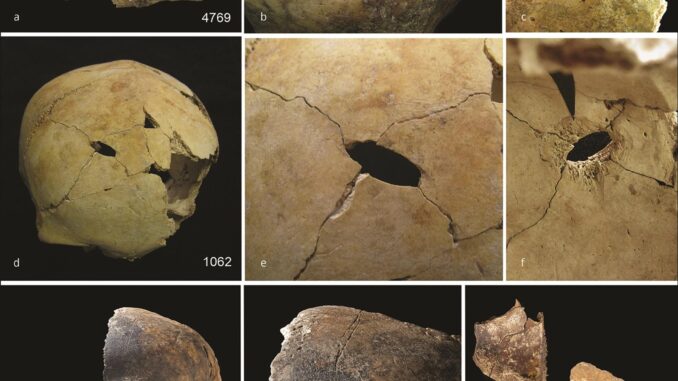 Ejemplos de traumatismo craneal. Arriba) lesión perimortem en la parte posterior izquierda del hueso frontal (a), también pueden verse marcas de corte en el hueso frontal (b) y el bisel patinado de la superficie craneal interna es evidente alrededor de la lesión (c); centro) cráneo con una lesión perforante en el hueso frontal medio (d), una vista más cercana muestra líneas de fractura radiales (e) y la vista interna muestra el bisel patinado (f ); inferior) cráneo de adulto (g), una inspección más cercana muestra marcas de corte a lo largo del frontal medio (h) y una fractura perimortem por objeto contundente en el fragmento de hueso frontal derecho contiguo (i) Crédito: Schulting et al. Antiquity, diciembre de 2024.
