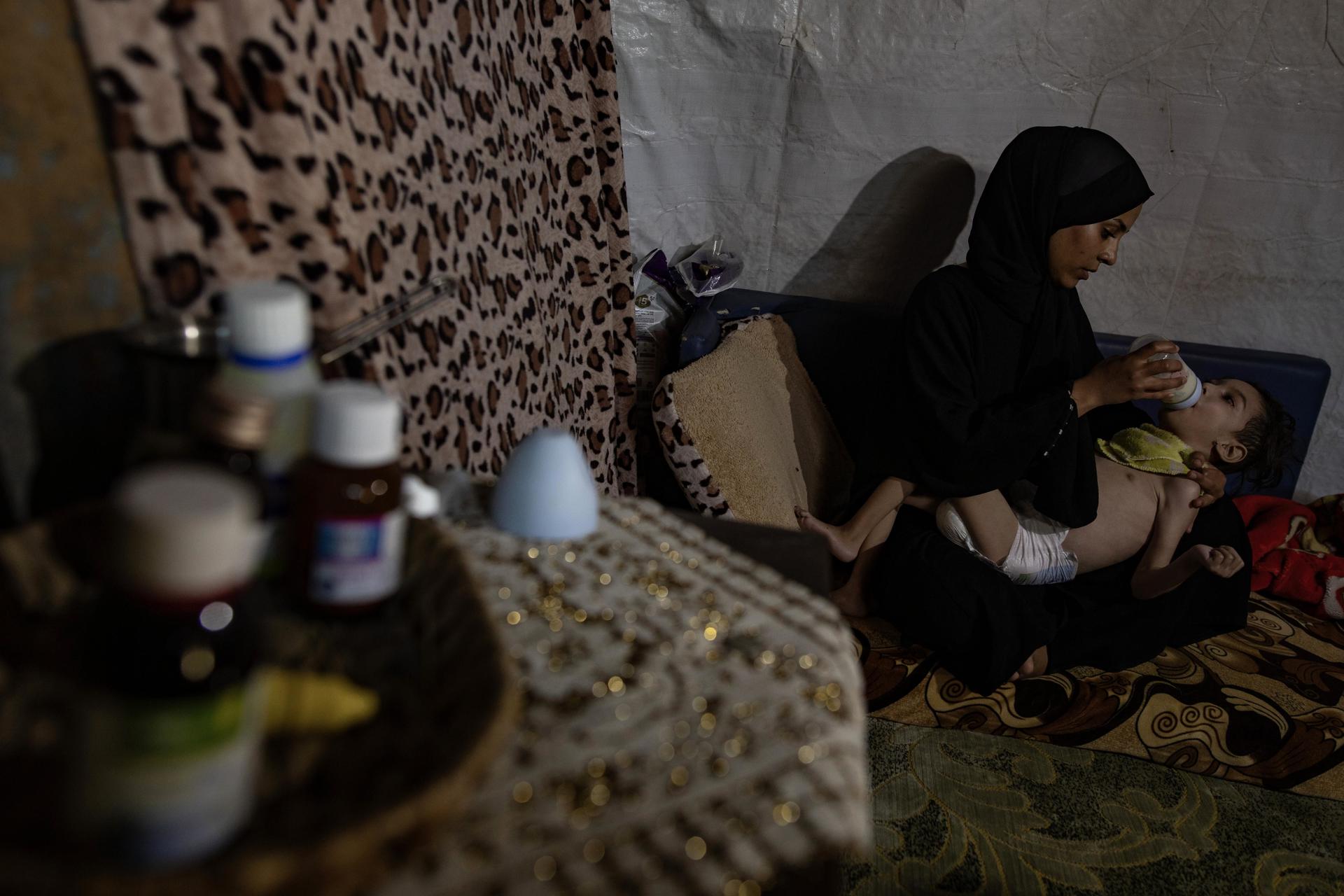 La madre palestina desplazada Reem Abo Jazar cuida de su hijo de cinco años Musa Abu Jazariya en su hogar en un campamento para personas desplazadas en Khan Yunis, en el sur de la Franja de Gaza, 19 de diciembre de 2024.  
EFE/EPA/HAITHAM IMAD
