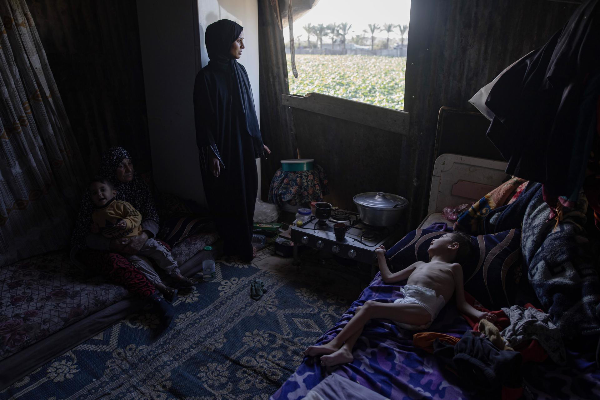 La madre palestina desplazada Reem Abo Jazar cuida de su hijo de cinco años Musa Abu Jazariya en su hogar en un campamento para personas desplazadas en Khan Yunis, en el sur de la Franja de Gaza, 19 de diciembre de 2024. 
EFE/EPA/HAITHAM IMAD
